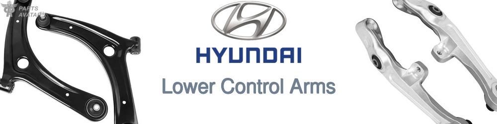 Discover Hyundai Control Arms Without Ball Joints For Your Vehicle