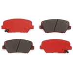 Order TRANSIT WAREHOUSE - SIM-1815 - Front Semi Metallic Pads For Your Vehicle