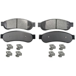 Order AGNA BRAKES - ALD1095M - Rear Semi Metallic Pads For Your Vehicle
