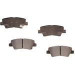 Order PROFUSION - PMD1594 - Rear Semi Metallic Pads For Your Vehicle