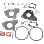 Order BLUE STREAK (HYGRADE MOTOR) - 1640 - Fuel Injection Throttle Body Repair Kit For Your Vehicle